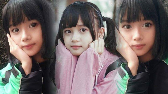 Foto Cewe Cantik Imut. VIRAL Gadis Cantik & Imut Ini Menarik Perhatian Karena Baby Face