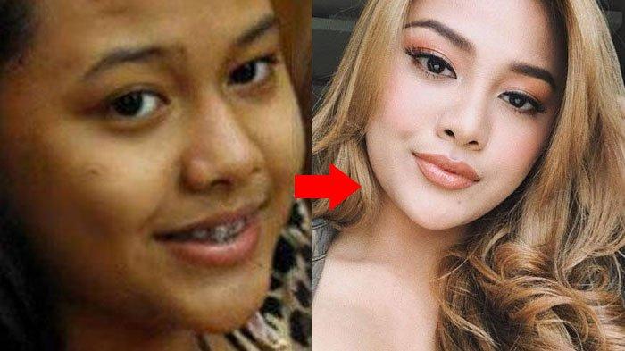 Review Dulu Jelek Sekarang Cantik. Dulu Tubuh Aurel Gendut dan Dihujat 'Jelek' Sejak SD, Putri